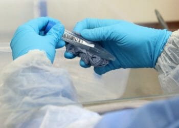 900 more coronavirus cases diagnosed in Cumbria